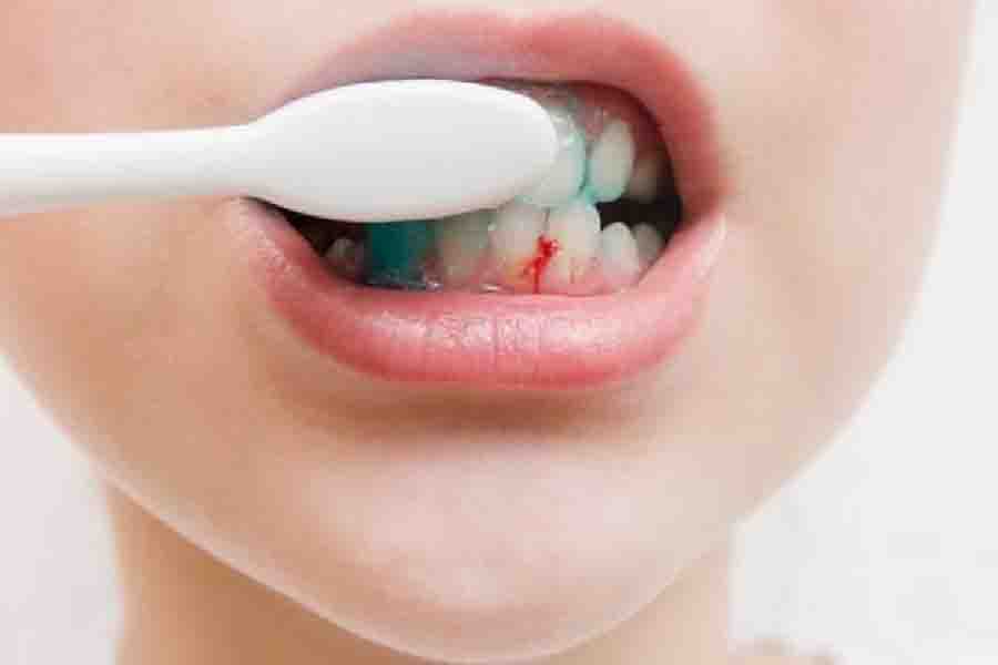Here are some home remedies for dental problems