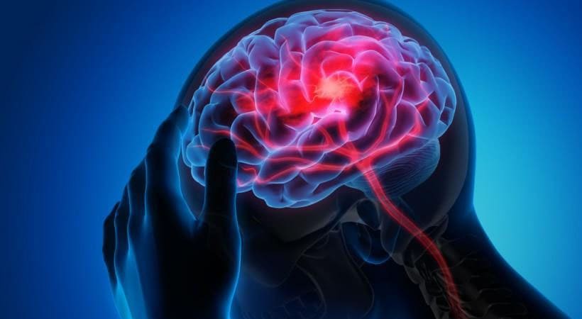Brain Stroke: The main cause of brain stroke is temperature increase, men are more at risk than women