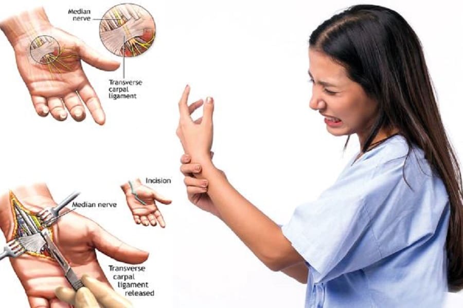 Hand or finger pain while using a laptop computer, do you know what disease you are suffering from?