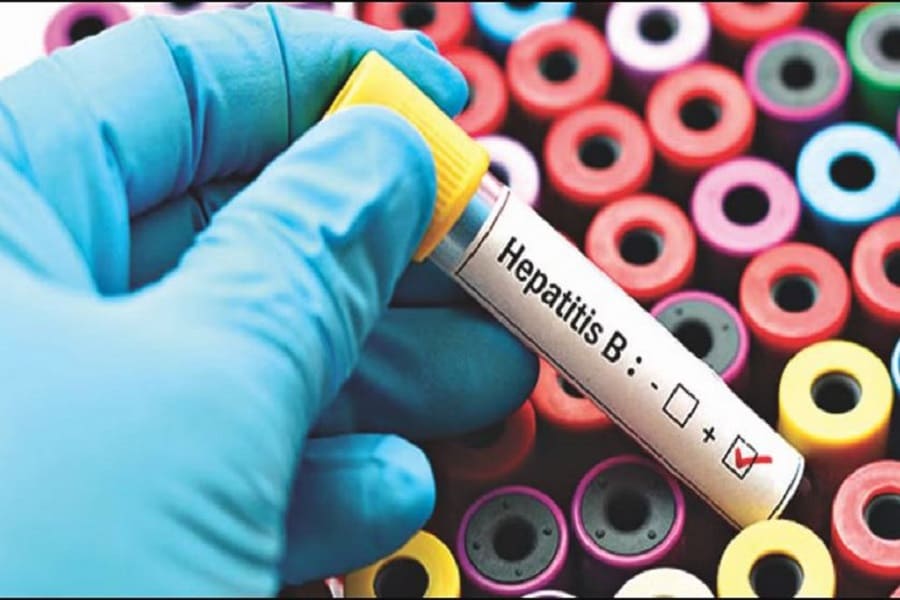 This time hepatitis B is spreading, 12 people have died in Kerala