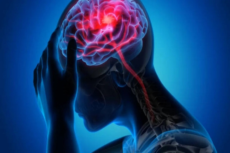 What are the signs and symptoms of stroke? Why is B Fast very important against this terrible disease?